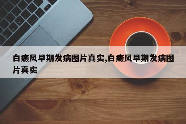 白癜风早期发病图片真实,白癜风早期发病图片真实