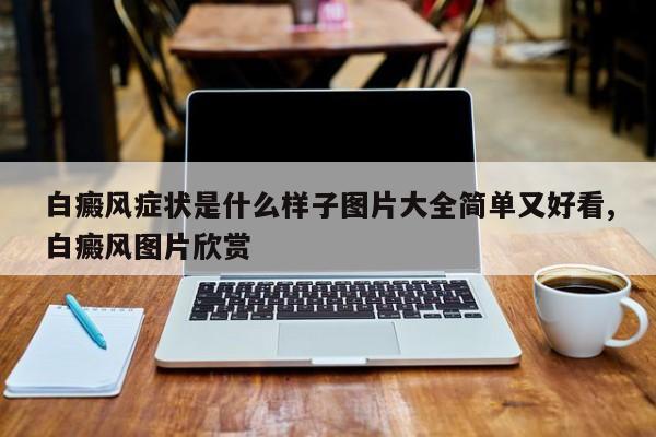 白癜风症状是什么样子图片大全简单又好看,白癜风图片欣赏