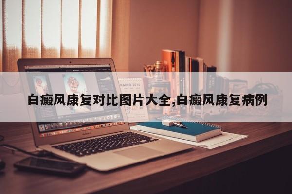 白癜风康复对比图片大全,白癜风康复病例
