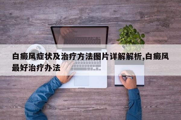 白癜风症状及治疗方法图片详解解析,白癜风最好治疗办法