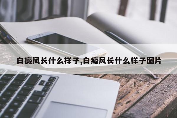 白癜风长什么样子,白癜风长什么样子图片